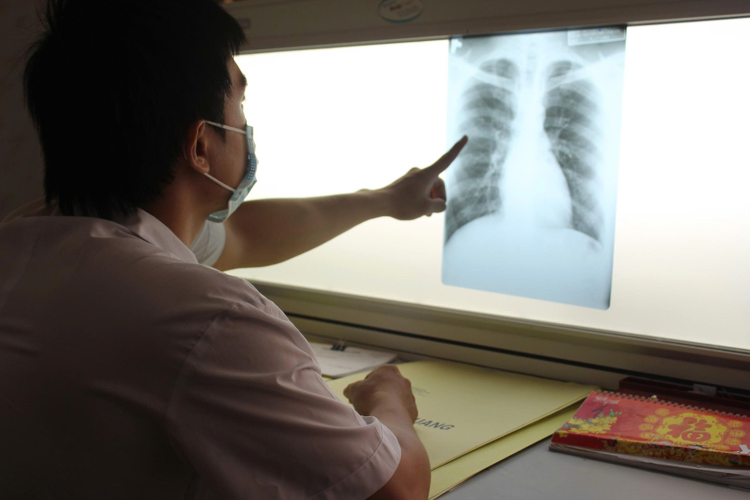 Bệnh viện  Phổi Ninh Thuận tổ chức giao ban Lao/HIV quý II/2025